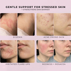 Hypochlorous acid facial and body spray
