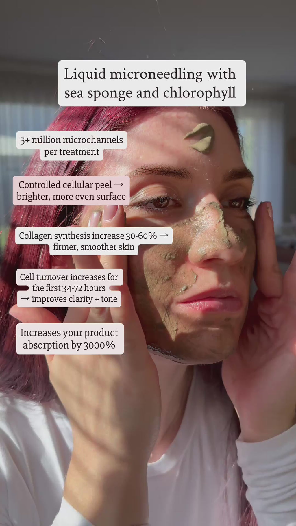 Spicule treatment bio microneedling