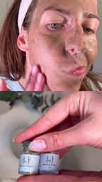 Liquid microneedling spicule treatment